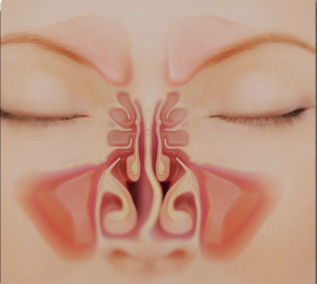 Ilustração de cirurgia de desvio de septo com foco na correção do septo nasal para melhorar a respiração.